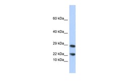 Aviva Systems Biology Corp LCN8 Antibody - N-terminal region (ARP58490_P050)