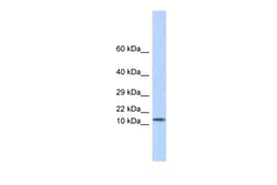 Aviva Systems Biology Corp LGALS1 Antibody - middle region (ARP58491_P050)