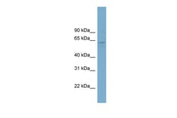 Aviva Systems Biology Corp MINDY4B Antibody - middle region (ARP58494_P050)