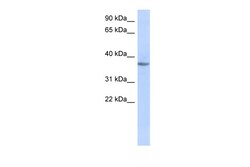 Aviva Systems Biology Corp OR10X1 Antibody - middle region (ARP58506_P050)