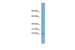 Aviva Systems Biology Corp RPL13A Antibody - middle region (ARP58522_P050)