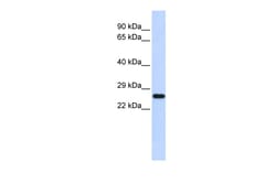 Aviva Systems Biology Corp SOD2 Antibody - N-terminal region (ARP58529_P050)