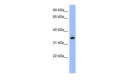 Aviva Systems Biology Corp GAPDH Antibody - middle region (ARP58580_P050)