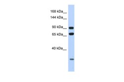 Aviva Systems Biology Corp ARMC4 Antibody - N-terminal region (ARP58586_P050)