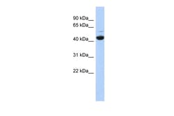 Aviva Systems Biology Corp ATP6V1C1 Antibody - N-terminal region (ARP58589_P050)