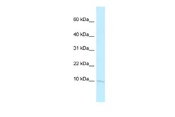 Aviva Systems Biology Corp Banf2 Antibody - N-terminal region (ARP58592_P050)