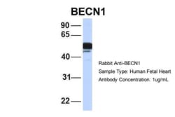 Aviva Systems Biology Corp BECN1 Antibody - N-terminal region (ARP58595_P050)