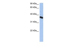 Aviva Systems Biology Corp BUB3 Antibody - N-terminal region (ARP58599_P050)