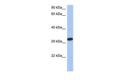 Aviva Systems Biology Corp CAPZA3 Antibody - N-terminal region (ARP58604_P050)