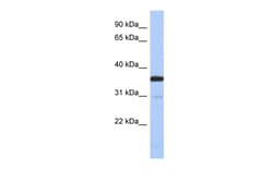 Aviva Systems Biology Corp ESD Antibody - N-terminal region (ARP58619_P050)