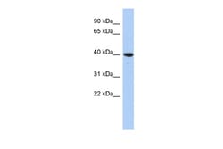 Aviva Systems Biology Corp GLRX3 Antibody - N-terminal region (ARP58626_P050)