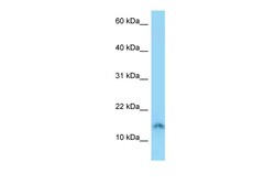Aviva Systems Biology Corp SPACA4 Antibody - N-terminal region (ARP58662_P050)