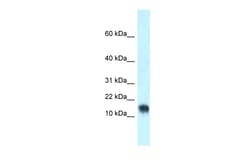 Aviva Systems Biology Corp Lynx1 Antibody - middle region (ARP58708_P050)