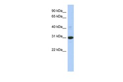 Aviva Systems Biology Corp IMPA1 Antibody - middle region (ARP58713_P050)