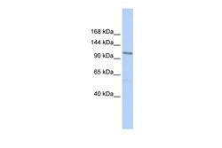 Aviva Systems Biology Corp TRPC3 Antibody - N-terminal region (ARP58715_P050)