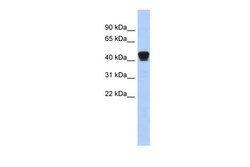 Aviva Systems Biology Corp TXNDC4 Antibody - middle region (ARP58726_P050)