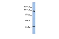 Aviva Systems Biology Corp SLIT1 Antibody - middle region (ARP58765_P050)