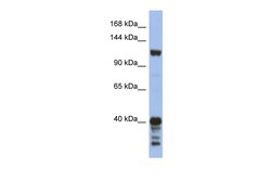 Aviva Systems Biology Corp SIPA1 Antibody - middle region (ARP58780_P050)
