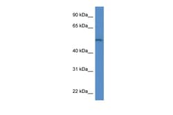 Aviva Systems Biology Corp Arsb Antibody - middle region (ARP58861_P050)
