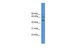 Aviva Systems Biology Corp ATG4D Antibody - middle region (ARP58865_P050)