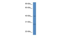 Aviva Systems Biology Corp Sh3glb1 Antibody - N-terminal region (ARP58875_P050)