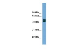 Aviva Systems Biology Corp CALR Antibody - middle region (ARP58880_P050)