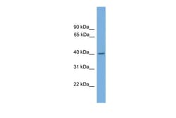 Aviva Systems Biology Corp MAPK1 Antibody - middle region (ARP58900_P050)