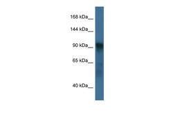 Aviva Systems Biology Corp Atg9a Antibody - C-terminal region (ARP58930_P050)