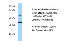 Aviva Systems Biology Corp PNPLA2 Antibody - middle region (ARP58938_P050)