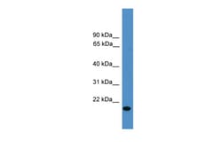 Aviva Systems Biology Corp VEGFB Antibody - middle region (ARP58975_P050)