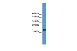 Aviva Systems Biology Corp CASP1 Antibody - middle region (ARP58983_P050)