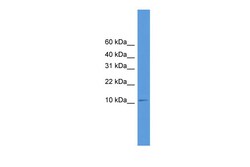 Aviva Systems Biology Corp CASP10 Antibody - middle region (ARP59000_P050)