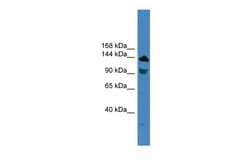 Aviva Systems Biology Corp TLR8 Antibody - C-terminal region (ARP59048_P050)