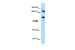 Aviva Systems Biology Corp SELE Antibody - N-terminal region (ARP59109_P050)