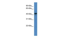 Aviva Systems Biology Corp RNF128 Antibody - C-terminal region (ARP59127_P050)