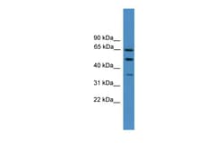 Aviva Systems Biology Corp ICAM1 Antibody - N-terminal region (ARP59129_P050)