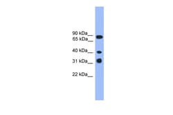 Aviva Systems Biology Corp LAX1 Antibody - C-terminal region (ARP59140_P050)