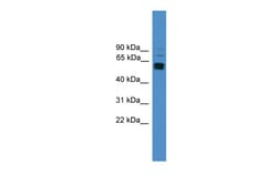 Aviva Systems Biology Corp LAG3 Antibody - C-terminal region (ARP59142_P050)