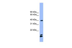 Aviva Systems Biology Corp NFATC1 Antibody - N-terminal region (ARP59145_P050)