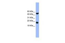 Aviva Systems Biology Corp RWDD1 Antibody - middle region (ARP59212_P050)