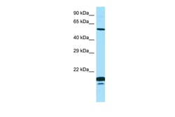 Aviva Systems Biology Corp SPINT1 Antibody - N-terminal region (ARP59227_P050)