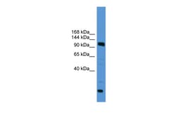Aviva Systems Biology Corp USP15 Antibody - C-terminal region (ARP59309_P050)