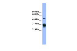 Aviva Systems Biology Corp PSMD9 Antibody - middle region (ARP59343_P050)