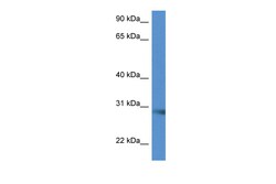 Aviva Systems Biology Corp Scamp5 Antibody - C-terminal region (ARP59469_P050)