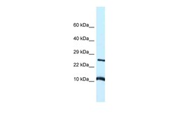 Aviva Systems Biology Corp Vamp8 Antibody - middle region (ARP59536_P050)