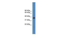 Aviva Systems Biology Corp BSND Antibody - middle region (ARP59578_P050)