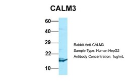 Aviva Systems Biology Corp CALM3 Antibody - N-terminal region (ARP59635_P050)