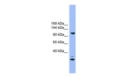 Aviva Systems Biology Corp STARD8 Antibody - N-terminal region (ARP59662_P050)