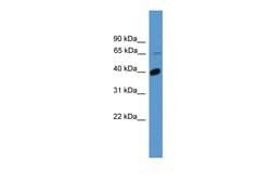 Aviva Systems Biology Corp OR2B2 Antibody - C-terminal region (ARP59715_P050)