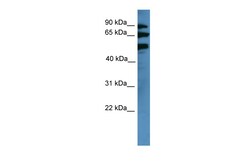 Aviva Systems Biology Corp BBS2 Antibody - middle region (ARP59751_P050)